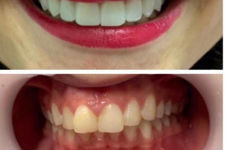 کلینیک دندانپزشکی لبخند،جراحی ایمپلنت پیشرفته،درمان ریشه،ترمیم دندان و ...