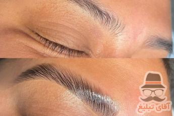 شیدینگ چشم، لیفت ابرو با مواد و شیدینگ لب: راهی به زیبایی طبیعی و ماندگار